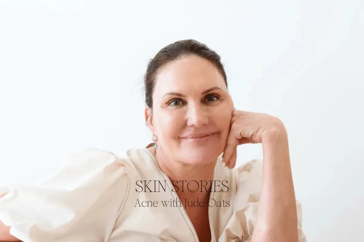 Skin Stories | Acne with Jude Oats